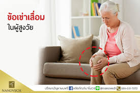 6 สมุนไพรไทย รักษาโรคข้อเข่าเสื่อม