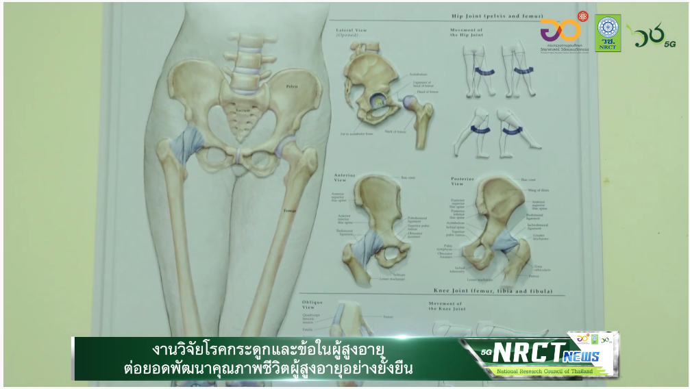 งานวิจัยโรคกระดูกและข้อในผู้สูงอายุต่อยอดพัฒนาคุณภาพชีวิตผู้สูงอายุอย่างยั่งยืน