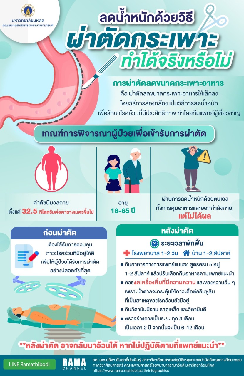 ลดน้ำหนักด้วยวิธีผ่าตัดกระเพราะ ทำได้จริงหรือไม่