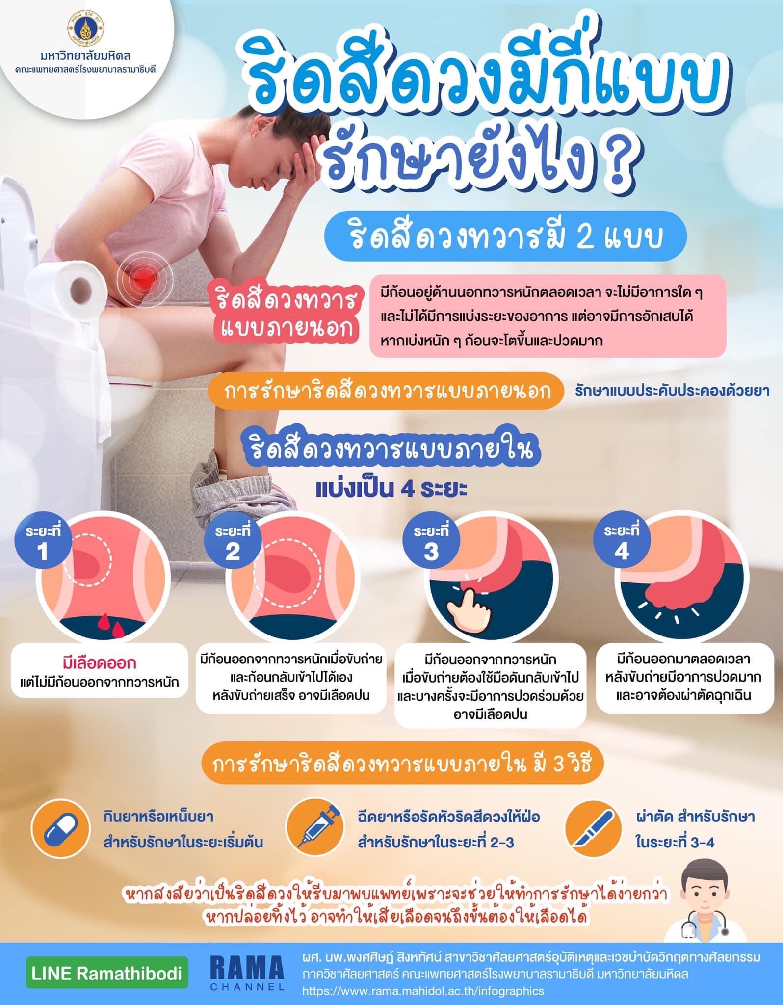 ริดสีดวงมีกี่แบบ รักษายังไง