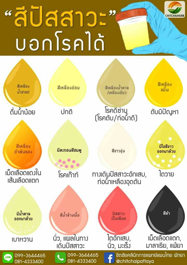 สีปัสสาวะบอกโรคได้