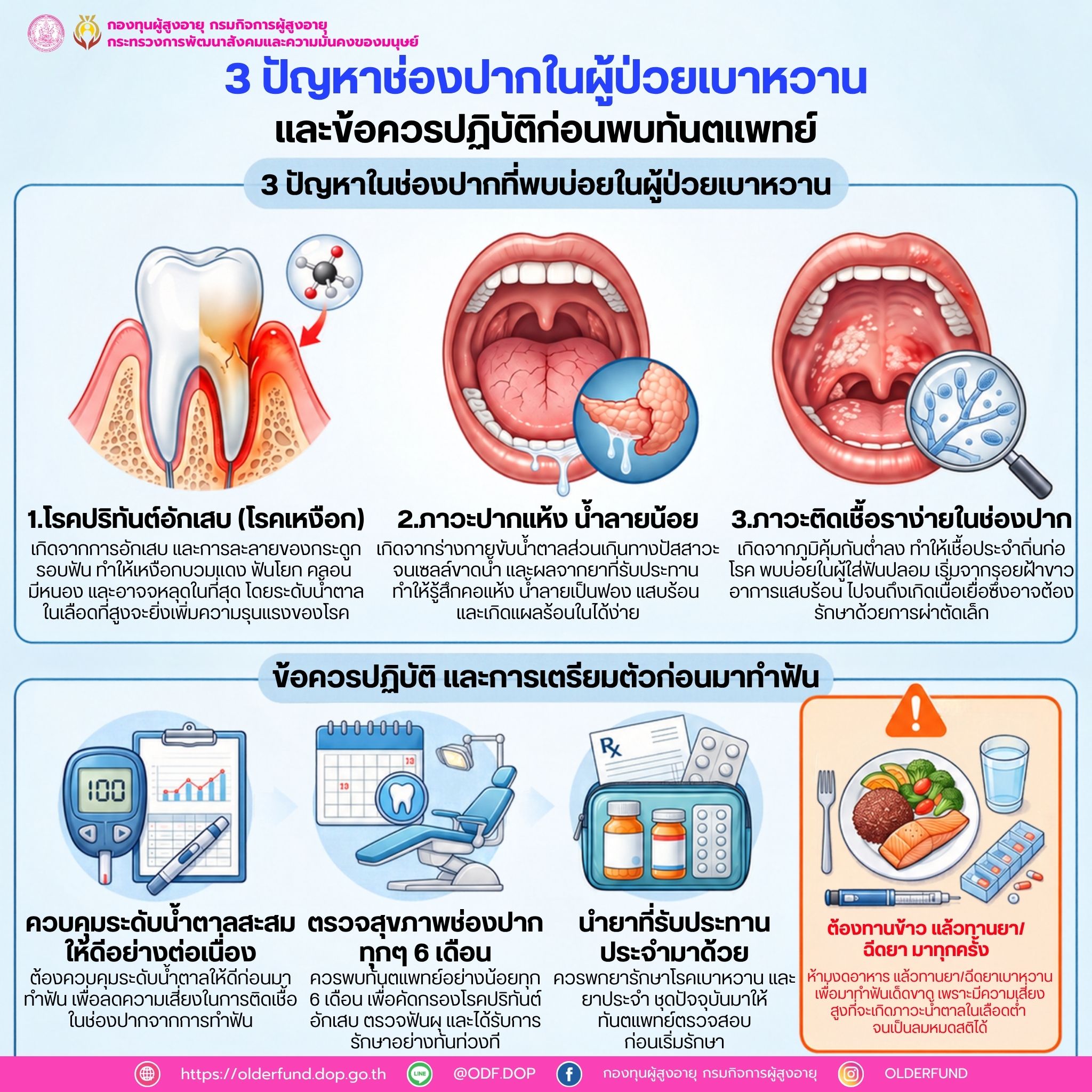 3 ปัญหาช่องปากในผู้ป่วยเบาหวาน และข้อควรปฏิบัติก่อนพบทันตแพทย์